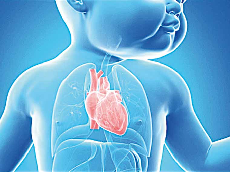 Cardiopatías congénitas Cardiopatías congénitas